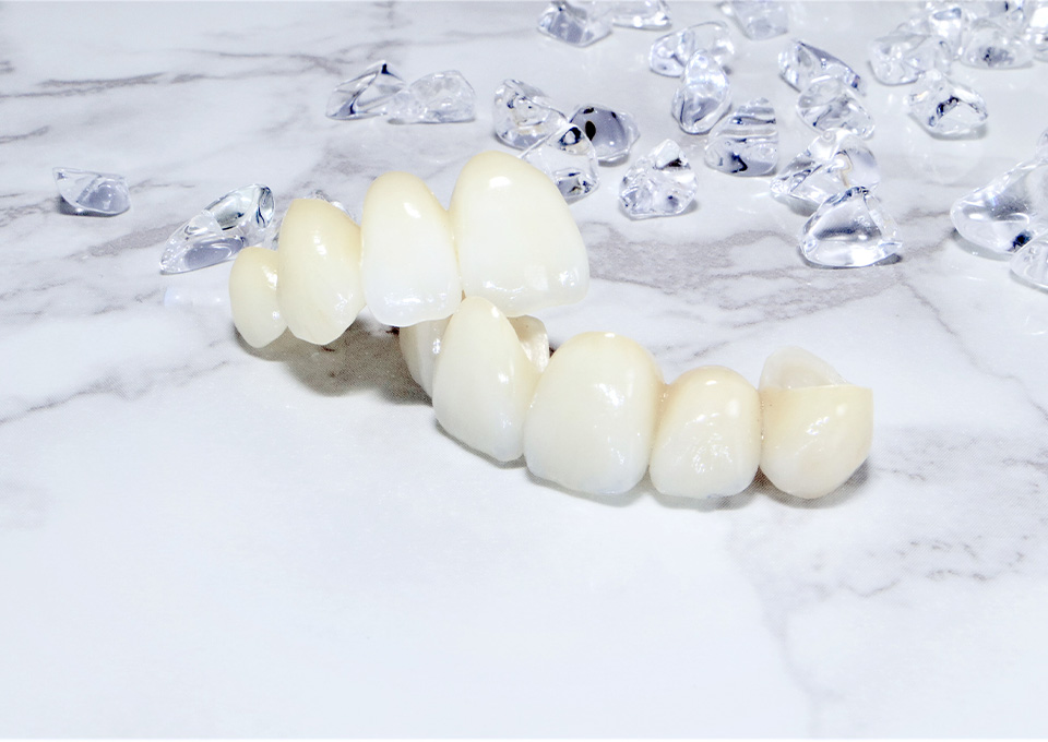 ジルコニアクラウン